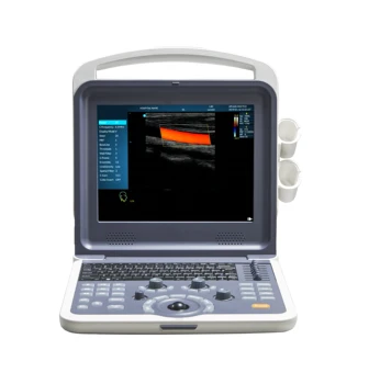 Obstetrica ecografie doppler color mașină china dispozitiv cu ultrasunete traductor de preț
